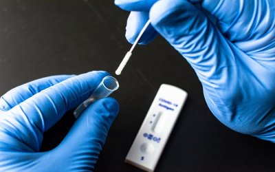 Δωρεάν rapid test στο Ληξούρι