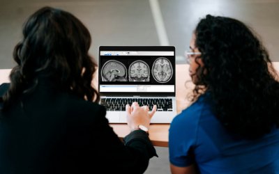 Ανεύρυσμα στον εγκέφαλο: Η εξέταση που μπορεί να μας σώσει τη ζωή