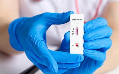 Σήμερα: Διεξαγωγή rapid test στο Ληξούρι