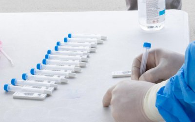 Κλιμάκιο του ΕΟΔΥ για διενέργεια rapid test σήμερα στην Ιθάκη